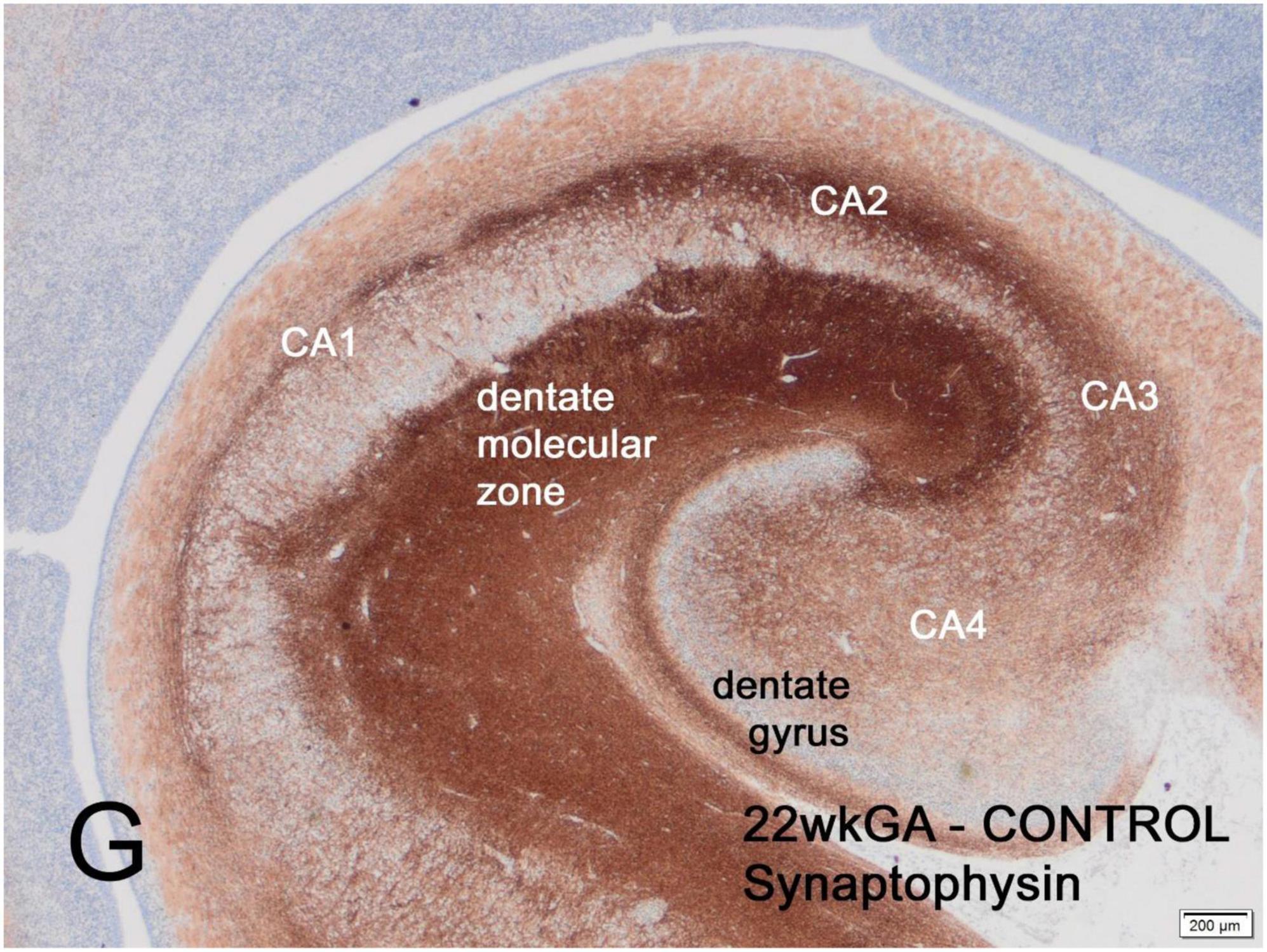 Sequences of synaptogenesis in the human fetal and neonatal brain by synaptophysin immunocytochemistry